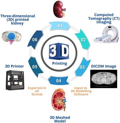 Role of three dimensional (3D) printing in endourology: An update from EAU young academic urologists (YAU) urolithiasis and endourology working group